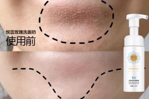什么样的洗面奶好用？型男美女洗脸首选悦蕾玫瑰莹润净颜慕斯