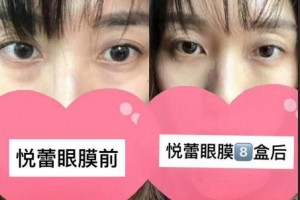 <strong>悦蕾植物抗衰多效眼膜：紧致去黑眼圈抗衰老 令双眸时刻保持光彩</strong>