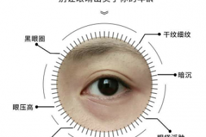 如何击退鱼尾纹？悦蕾植物抗衰多效眼膜让你找回逝去的青春