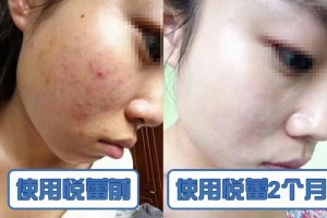 <strong>悦蕾冰泉焕颜蚕丝面膜：满足爱美女性祛黄补水需求</strong>