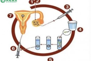 希恩宝贝-哈萨克斯坦试管婴儿步骤详解：每一步都至关重要
