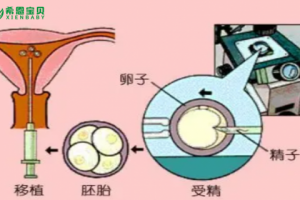 希恩宝贝-哈萨克斯坦辅助生殖专家揭秘：习惯性流产是如何通过试管婴儿助孕的？