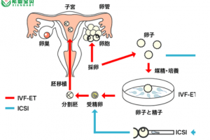 希恩宝贝-试管婴儿流程中的关键点：哈萨克斯坦专家为您的成功之路护航