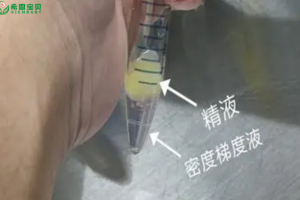 精子质量优化，哈萨克斯坦试管婴儿男科专家为您助力