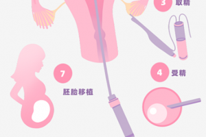 希恩宝贝-哈萨克斯坦试管婴儿流程详解：从促排到移植的每一步