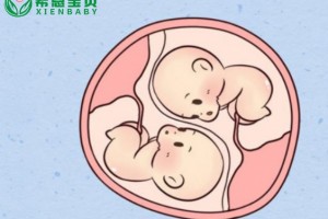 希恩宝贝：哈萨克斯坦试管婴儿生双胞胎的概率与试管费用多少钱？